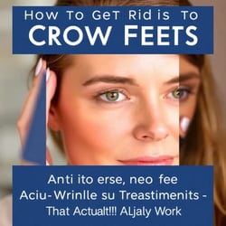 How to Get Rid of Crow's Feet: Anti-Aging Eye Wrinkle Treatments That Actually Work