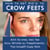 How to Get Rid of Crow's Feet: Anti-Aging Eye Wrinkle Treatments That Actually Work