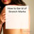 How to Get Rid of Stretch Marks: What Actually Works According to Dermatologists and Science