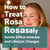 How to Treat Rosacea Naturally: Gentle, Effective Remedies and Lifestyle Changes