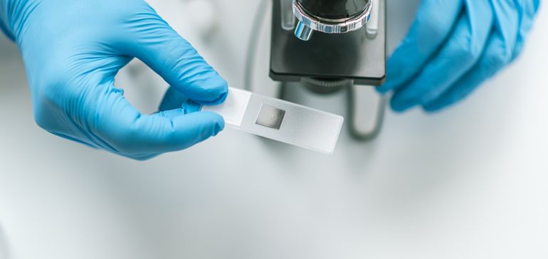 UnitedHealth’s Optum looks to cut down on unnecessary lab testing UnitedHealth’s Optum looks to cut down on unnecessary lab testing
