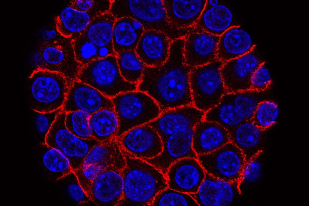 Biopharma has a brand new target: Cancer-specific collagen – MedCity News Biopharma has a brand new target: Cancer-specific collagen – MedCity News
