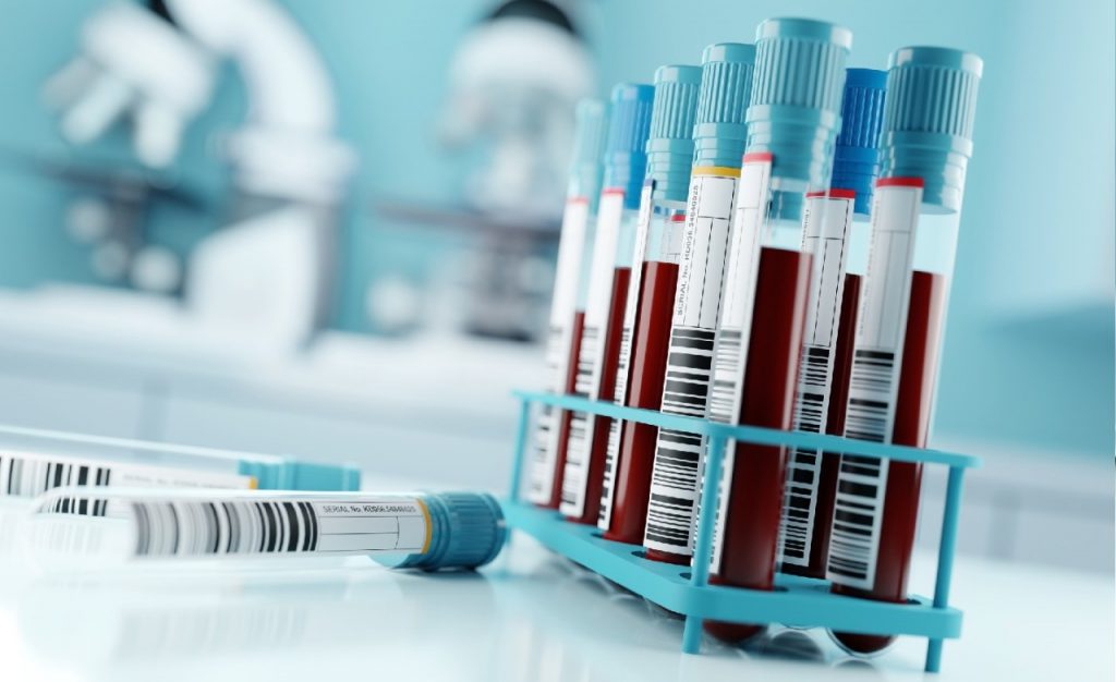 Blood tests for ‘forever chemicals’ should be offered to patients with high exposure: report Blood tests for ‘forever chemicals’ should be offered to patients with high exposure: report