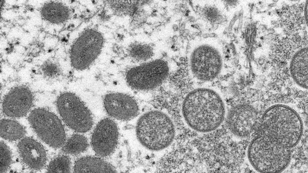 Monkeypox vaccine appointment website crashes in New York City Monkeypox vaccine appointment website crashes in New York City