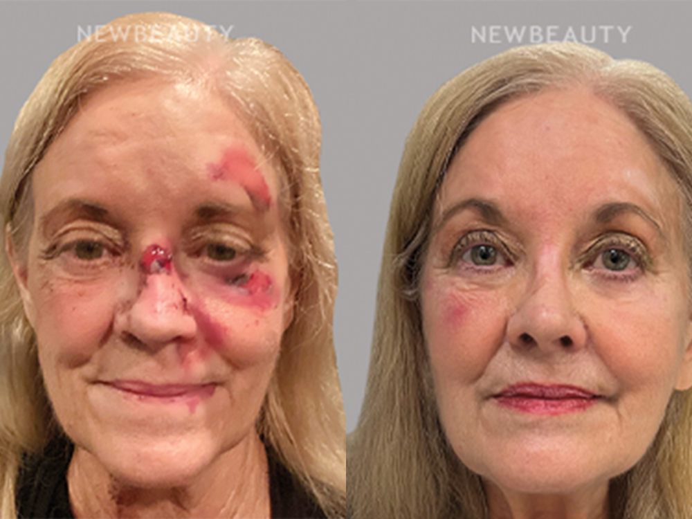 This Line Produces Amazing Benefits After Facial Trauma or Radiation Exposure This Line Produces Amazing Benefits After Facial Trauma or Radiation Exposure