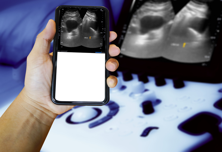 We’re in an era experiencing a tectonic shift in foundations of medical imaging – MedCity News We’re in an era experiencing a tectonic shift in foundations of medical imaging – MedCity News