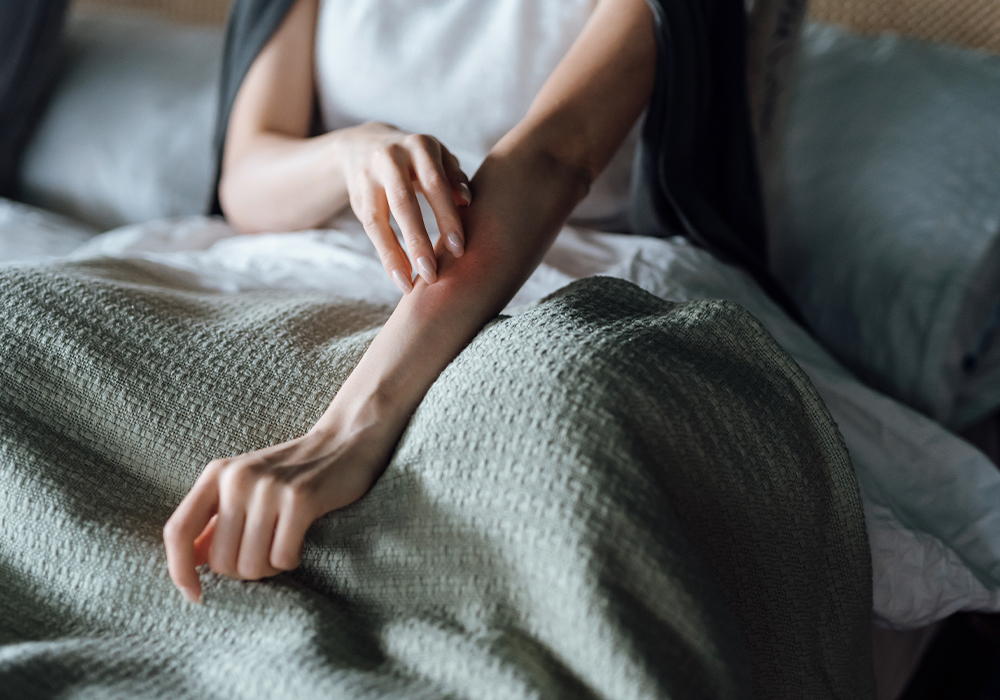 What Skin Experts Want You to Know About the Monkeypox Rash and Scarring What Skin Experts Want You to Know About the Monkeypox Rash and Scarring